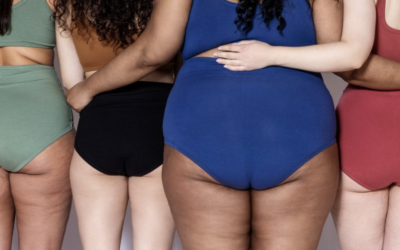 Cellulite: Do we care and what can be done?